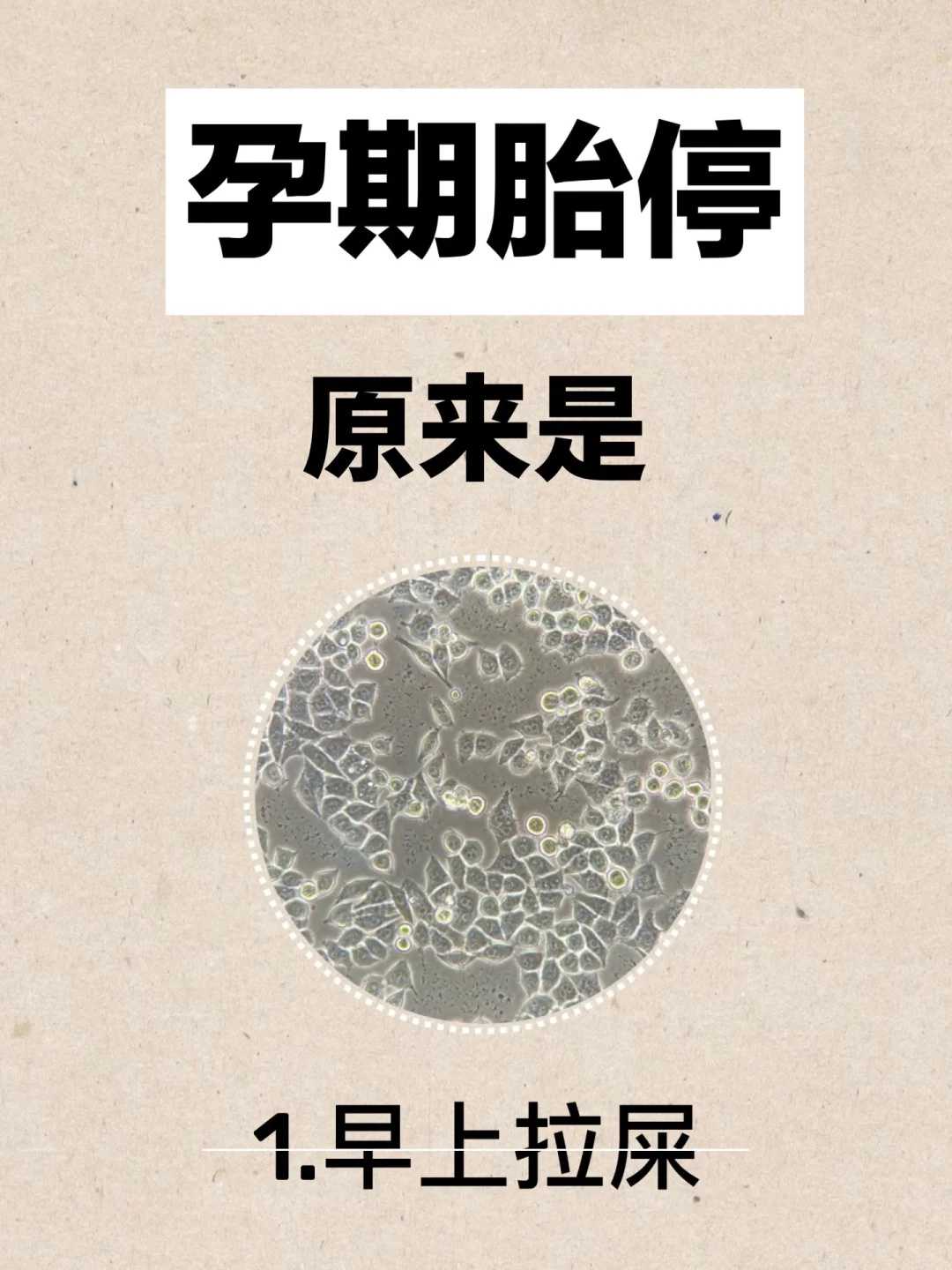 试管移植成功后，准妈妈体内激素有怎样的变化？三代试管婴儿 价格