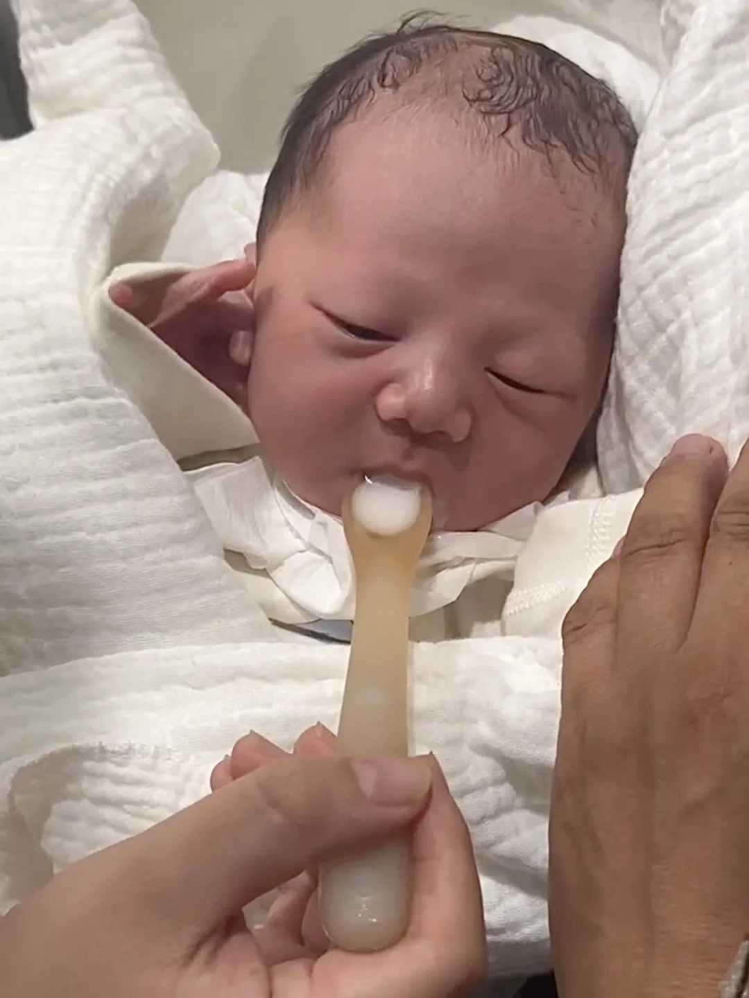 生殖助孕中心供卵供卵试管科普：做试管婴儿手术需要住院吗