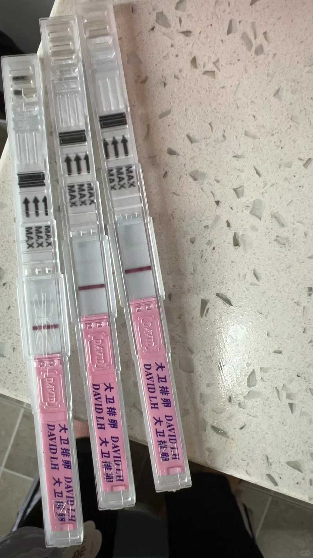 代生-睾丸穿刺取精？睾丸取精手术需要全麻吗？